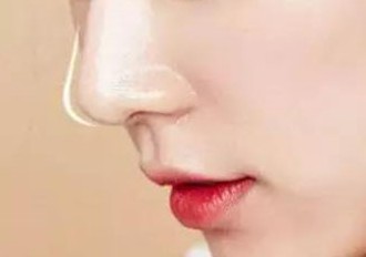 鼻综合整形能维持多长时间